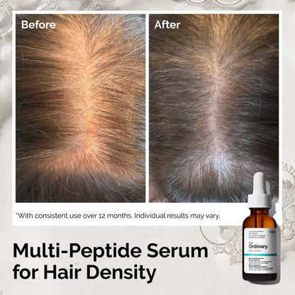 The Ordinary Multi-Peptide Serum for Hair Density 60Ml